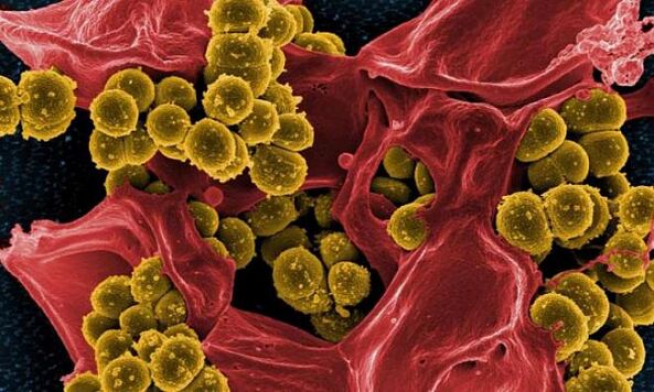 Staphylococcus aureus bilang isang sanhi ng bacterial prostatitis