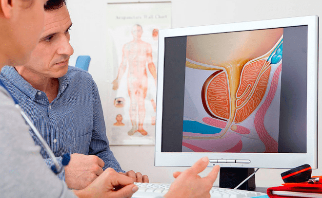 Diagnosis ng prostatitis